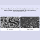 Xiaomi Mijia T302 Sonic Electric Toothbrush with DuPont Antibacterial Bristles Four Cleaning Modes 150 Days Battery Life 360 Wireless Charging, and IPX8 Waterproof for Comprehensive Oral Hygiene Care