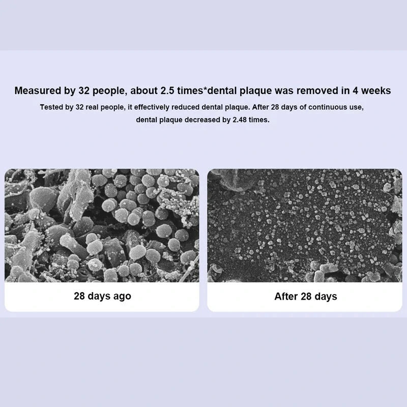 Xiaomi Mijia T302 Sonic Electric Toothbrush with DuPont Antibacterial Bristles Four Cleaning Modes 150 Days Battery Life 360 Wireless Charging, and IPX8 Waterproof for Comprehensive Oral Hygiene Care