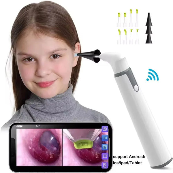 Wireless Otoscope Ear Camera 3.9mm 1080P HD WiFi Ear Scope with 6 LED Lights for Kids and Adults Support Android iOS Phone